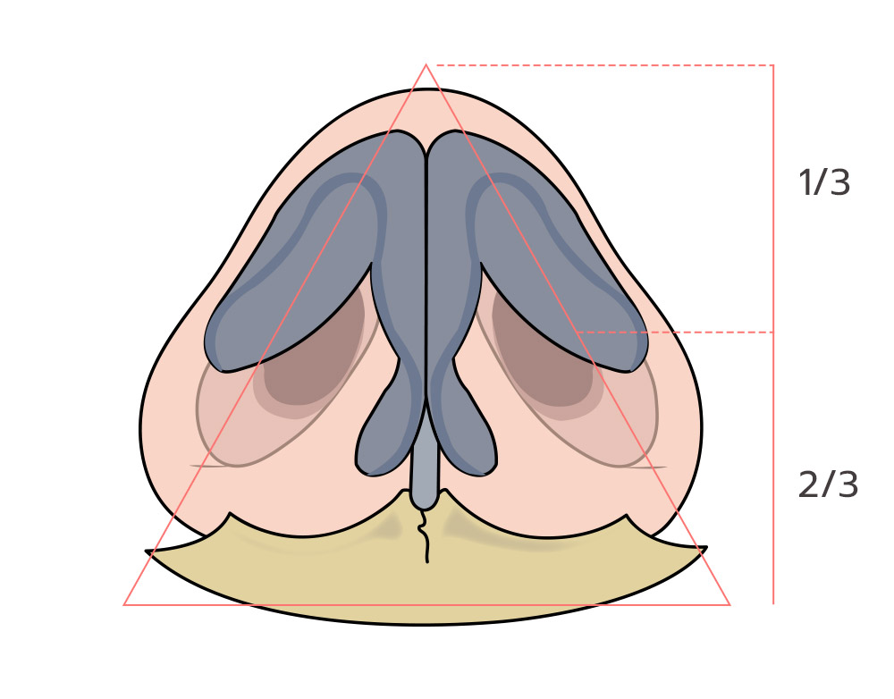 Female Rhinoplasty
