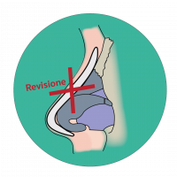 icon revision rhinoplasty